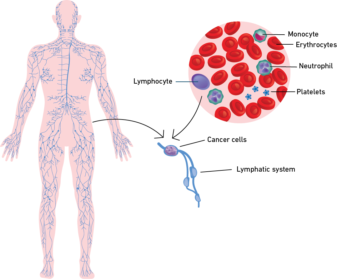 Anatomical illustration of the female lymphatic system
